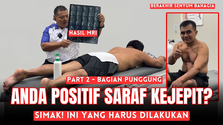 MCO ARIF - POSITIVE PINCHED NERVE THIS IS WHAT TO DO, WATCH THE VIDEO! PART 2