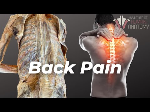 Video: Kan sakral fordybning forårsage rygsmerter?