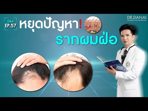 หยุดปัญหา รากผมฝ่อ! By Dr.Danai | Q&A Episode 57