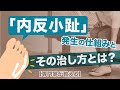 【足の専門家が教える】内反小趾の原因は？、どうすれば改善できるのか？