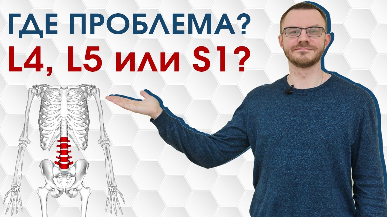 Как узнать на уровне какого позвонка проблема? Уровень L4, L5 или S1? Двигательные тесты.