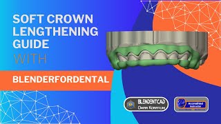 Soft-Tissue Crown-lengthening Guide using Blenderfordental screenshot 2