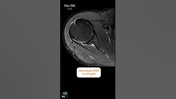 MRI SHOULDER – KNOW YOUR TECHNIQUES WELL