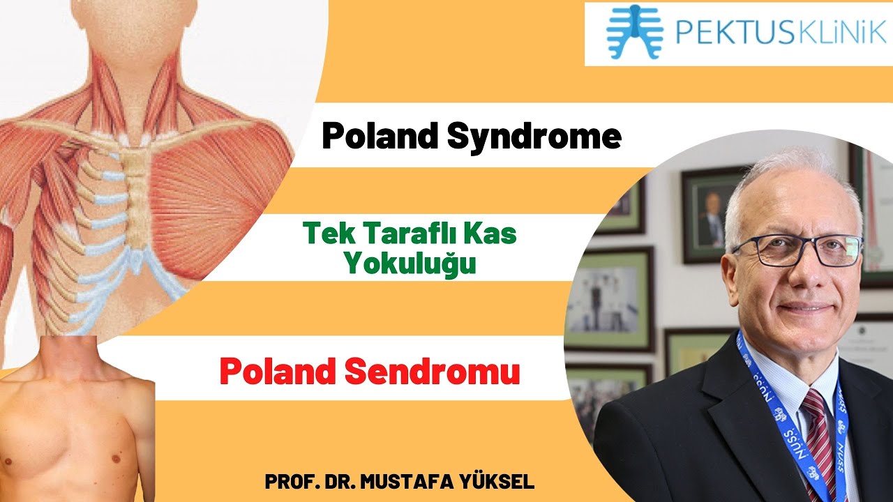 Prof Dr Mustafa Yuksel Trt Roportaji Youtube