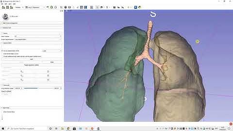 Easy lung mask generation including airway segmentation with LungCTSegmenter and 3D Slicer