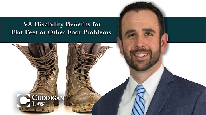 VA Disability Benefits for Flat Feet or Other Foot Problems?