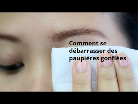 Vidéo: 3 façons naturelles de surmonter les problèmes de vision