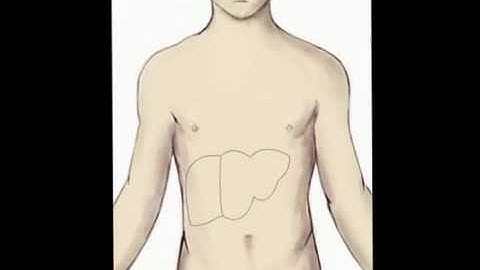 Portal Vein Embolization (PVE) for Contralateral Liver Hypertrophy