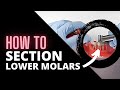 Tips For Sectioning Mandibular Molars | OnlineExodontia.com