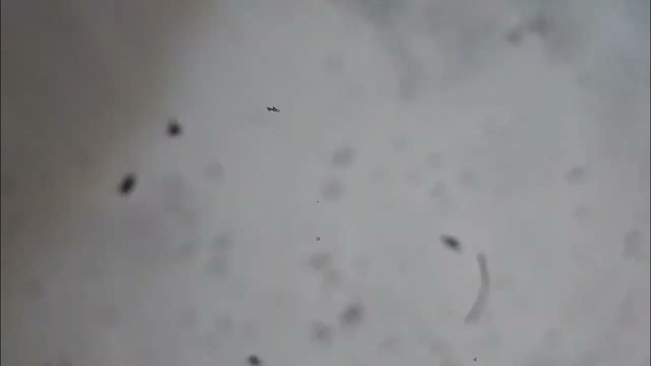 WHY IS MY CAMERA HAS BLACK SPOT??? YouTube