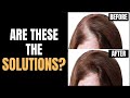 Hair Loss Treatment For Women // SOLUTIONS THAT WORK! #laserhairtherapy #hairloss #hairgrowth