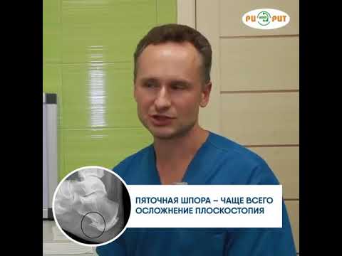 Все о пяточной шпоре за 1 минуту