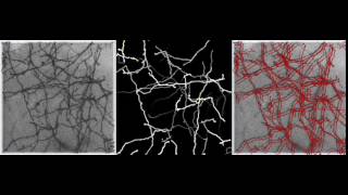Automated neuron tracing using probability hypothesis density filtering