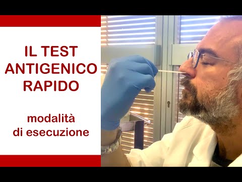 Il #Test #Antigenico Rapido. Modalità di esecuzione passo dopo passo.
