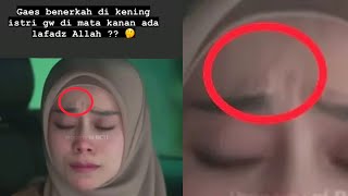 Misteri LAFADZ ALLAH di Kening Lesti, BILLAR TAK PERCAYA❓