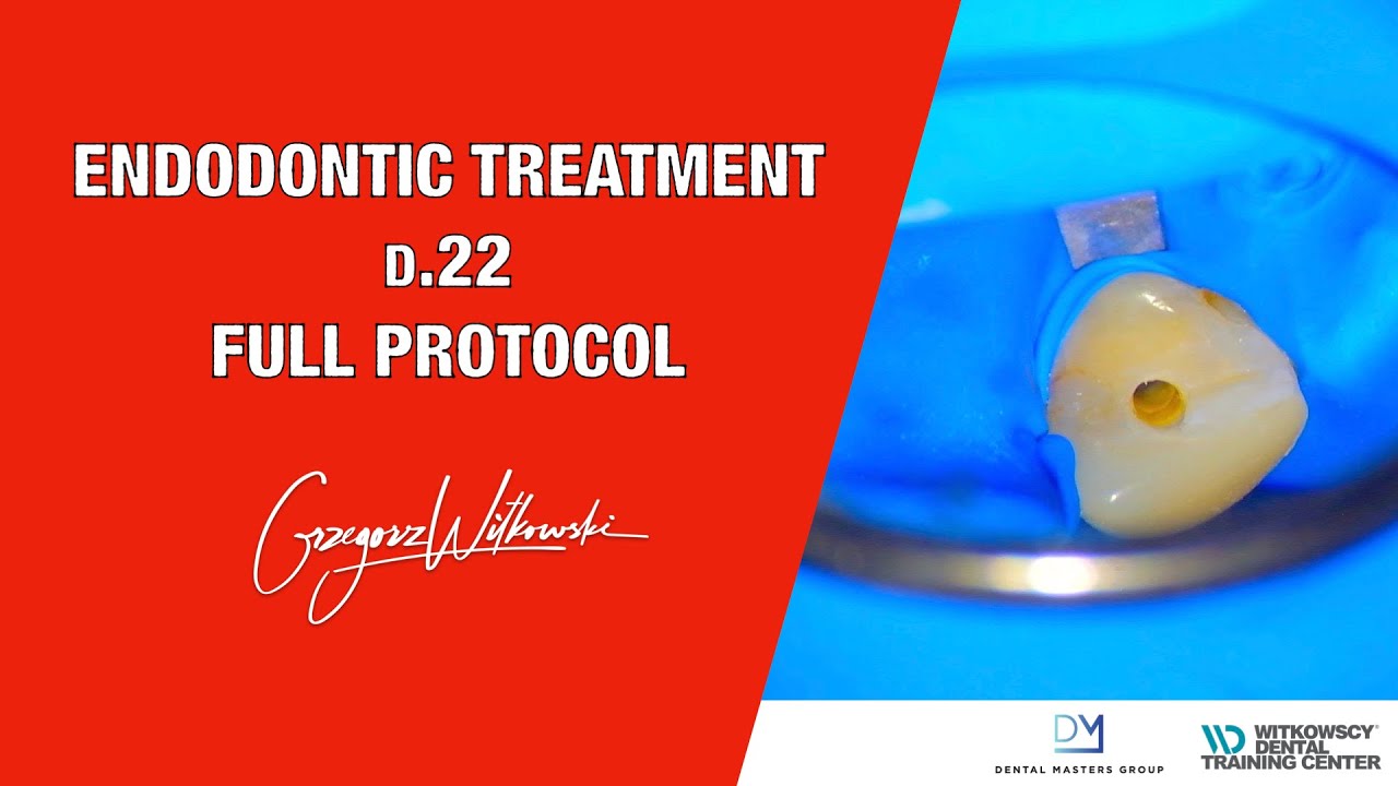 Endodontic treatment full protocol d.22 YouTube