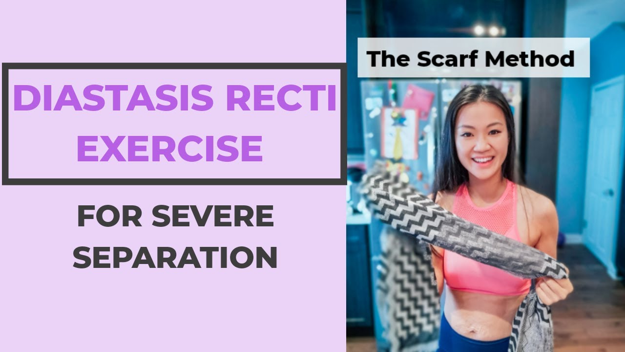 Diastasis Recti Exercise The Scarf Method YouTube