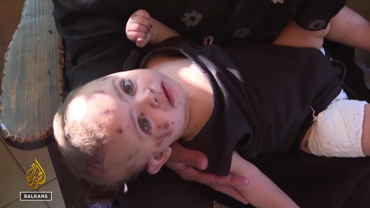 بيبي هو الناجي الوحيد من القصف الإسرائيلي لمنزل عائلته في غزة