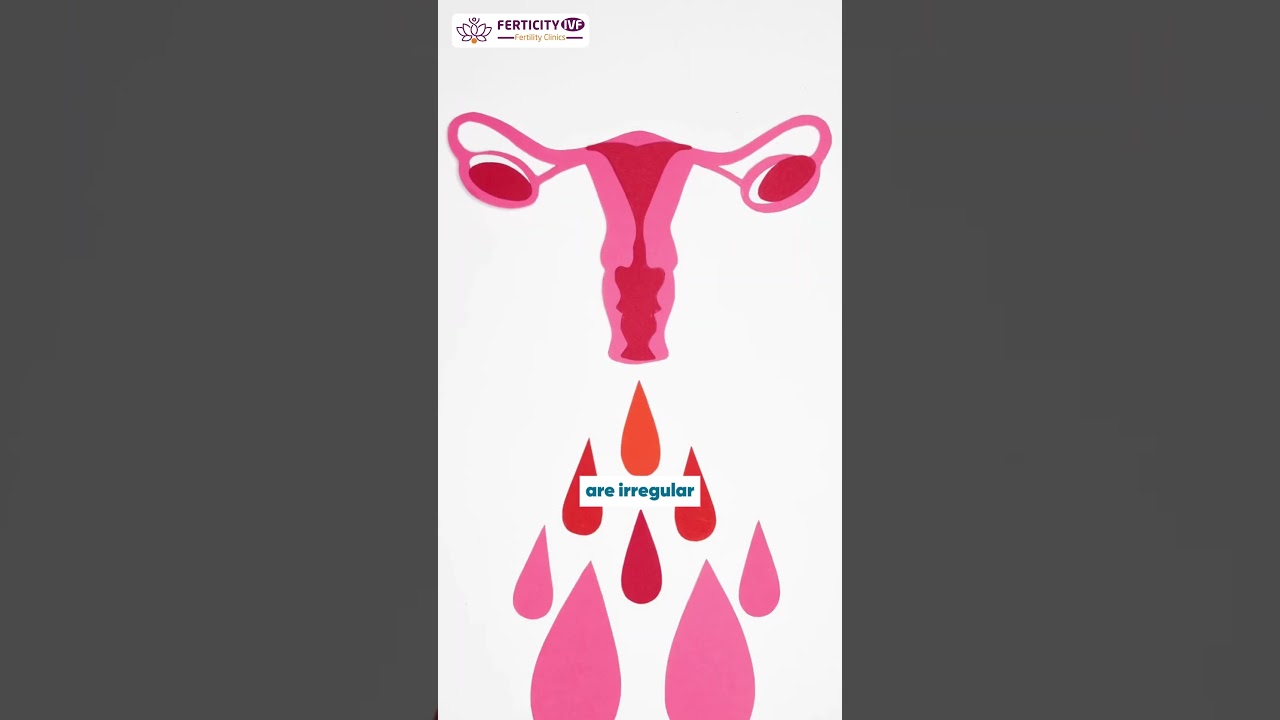Wondering if you need to meet a fertility specialist? #ferticityivf #fertility #infertility #ivf