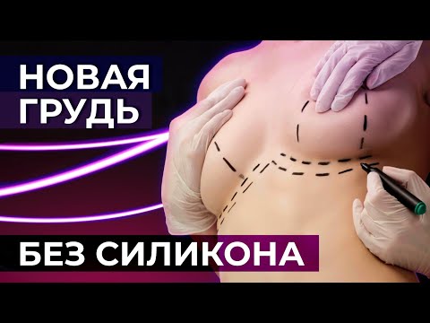 Реконструкция груди собственными тканями | DIEP лоскут | TRAM лоскут