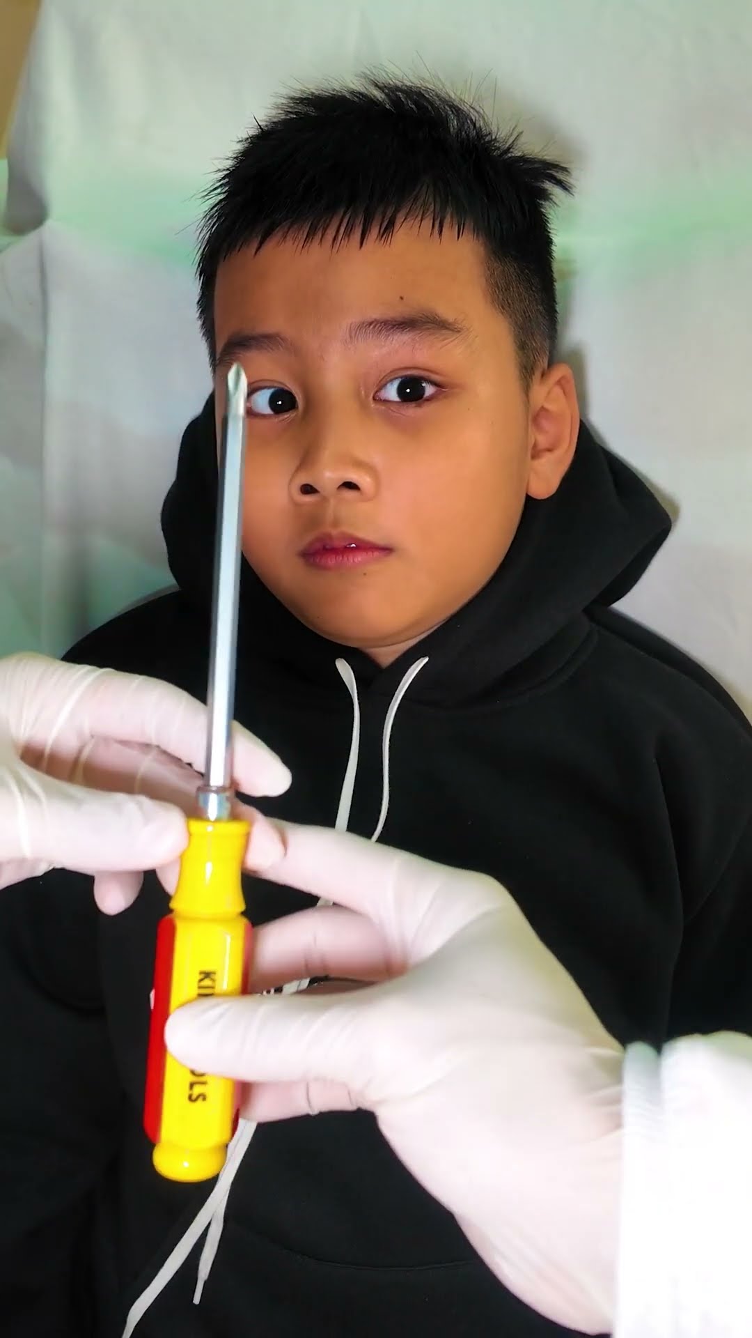 ACC - Câu Chuyện Khi Tôi Đi Nha Khoa || The Story of When I Went to the Dentist. #funny #trending