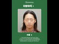 #더비비성형외과 지방이식은 단순히 부족한 곳을 채우는 수술