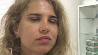 Снятие швов после пластики век