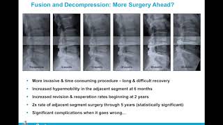 IINN Grand Rounds: Coflex Interlaminar Stabilization: History, Research & Clinical Applications