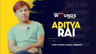 Aditya Rai | The Hidden Wounds | Stories of Nepal’s LGBTIQ  Community | EP 06