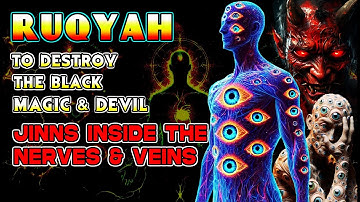 Complete Ruqyah to treat Black Magic, Possession, Evil Eye, Envy, Disturbances From Jinns & Demons