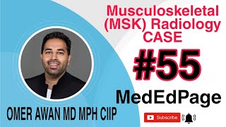 Musculoskeletal (MSK) Radiology CASE #55