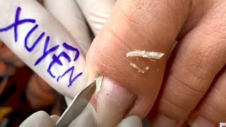 How to Repair Nails easy # 436 - Xuyen Nail