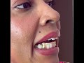 Classy Grillz 🤩💛