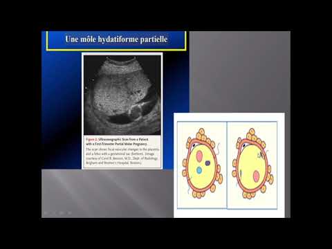 Vidéo: Glandes Surrénales - Structure, Fonction, Maladies, Tumeurs, Traitement