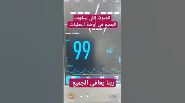 صوت المونيتور داخل غرفة العمليات 