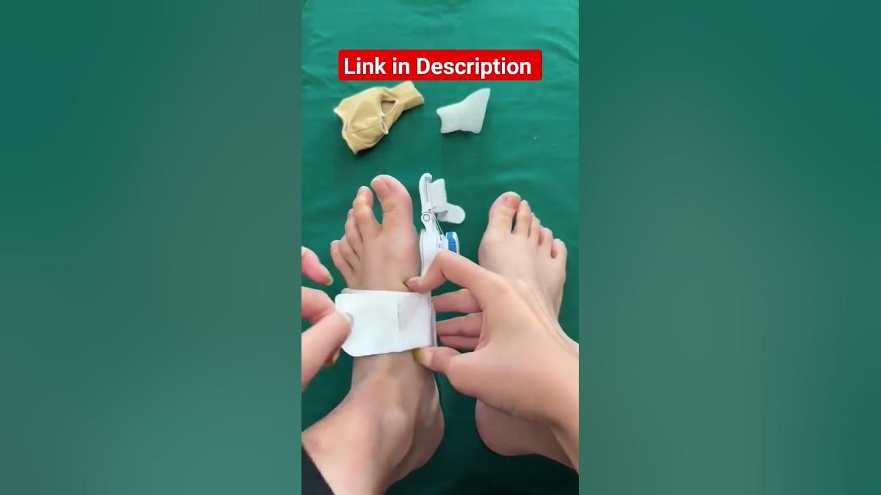 Bunion Splint Women Men Adjustable Direction Bunion Corrector YouTube