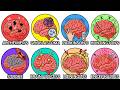 Every Deadly Brain Disorder Explained in 22 Minutes (No BS)