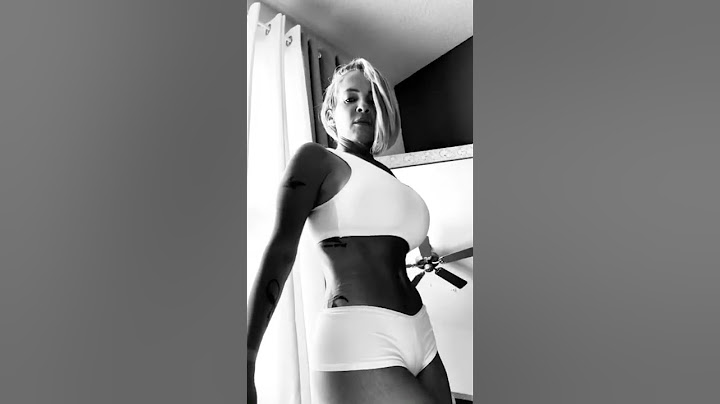 Mommy makeover 2 years post-op by Dr. Z 😍