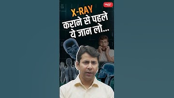X -RAY कराने से पहले ये जान लो..#riteshjaiswalsir #science #sanskritiias #upsc #viral #viralshort