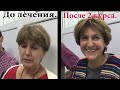 865. О первых 10 днях 30-дневного курса RANC. Краткая версия.