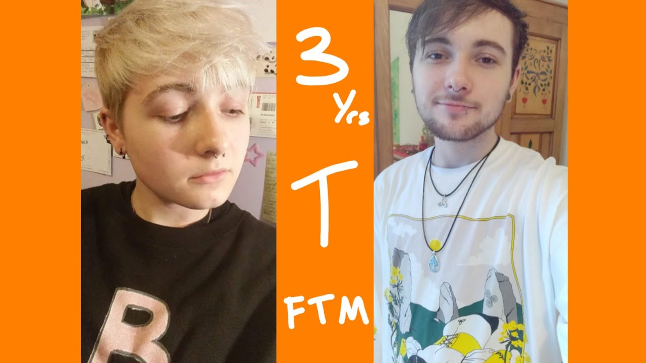 3 Years of Testosterone - FTM Transgender