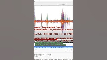 Epilepsy seizure detection using eeg and ecg _ Matlab _ Epilepsy seizure _ EEG _ seizure