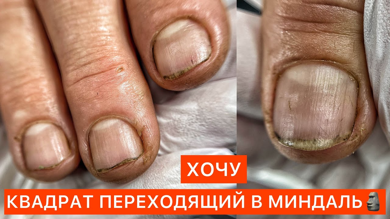 ТЫ ЧЕ НЕ ПОНЯЛА? 🤡ТРЕШ НАРАЩИВАНИЕ УБИТЫХ НОГТЕЙ 👻😱