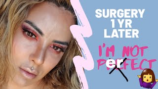1 YR Jaw Surgery// FFS// Facial Feminization Surgery