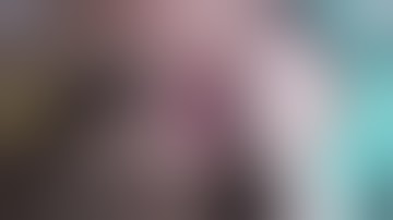 Cyclophotocoagulation with Subconjunctival Anesthesia