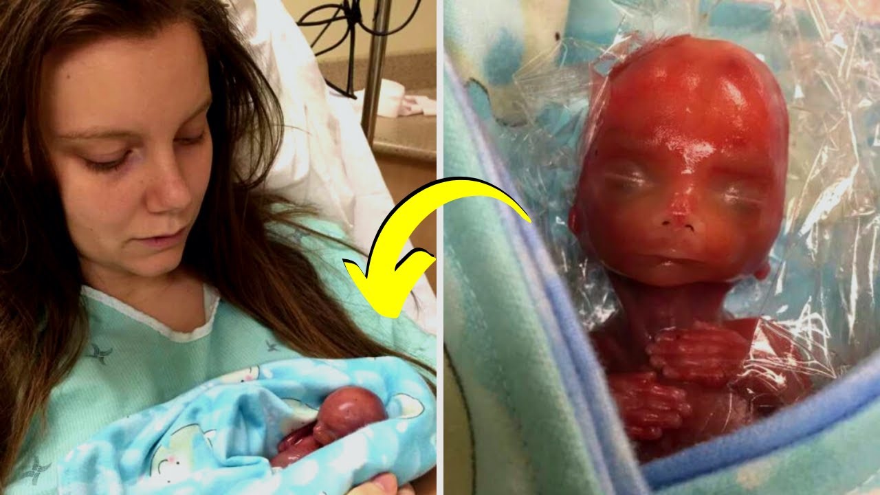 Viereinhalb Monate zu früh geboren: Paulina kämpft sich ins Leben | stern TV