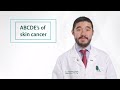 Minute of Wellness: ABCDE of Skin Cancer