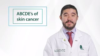 Minute of Wellness: ABCDE of Skin Cancer