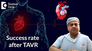 What is the success rate after TAVI/TAVR? #cardiologist  - Dr. Durgaprasad Reddy B | Doctors' Circle