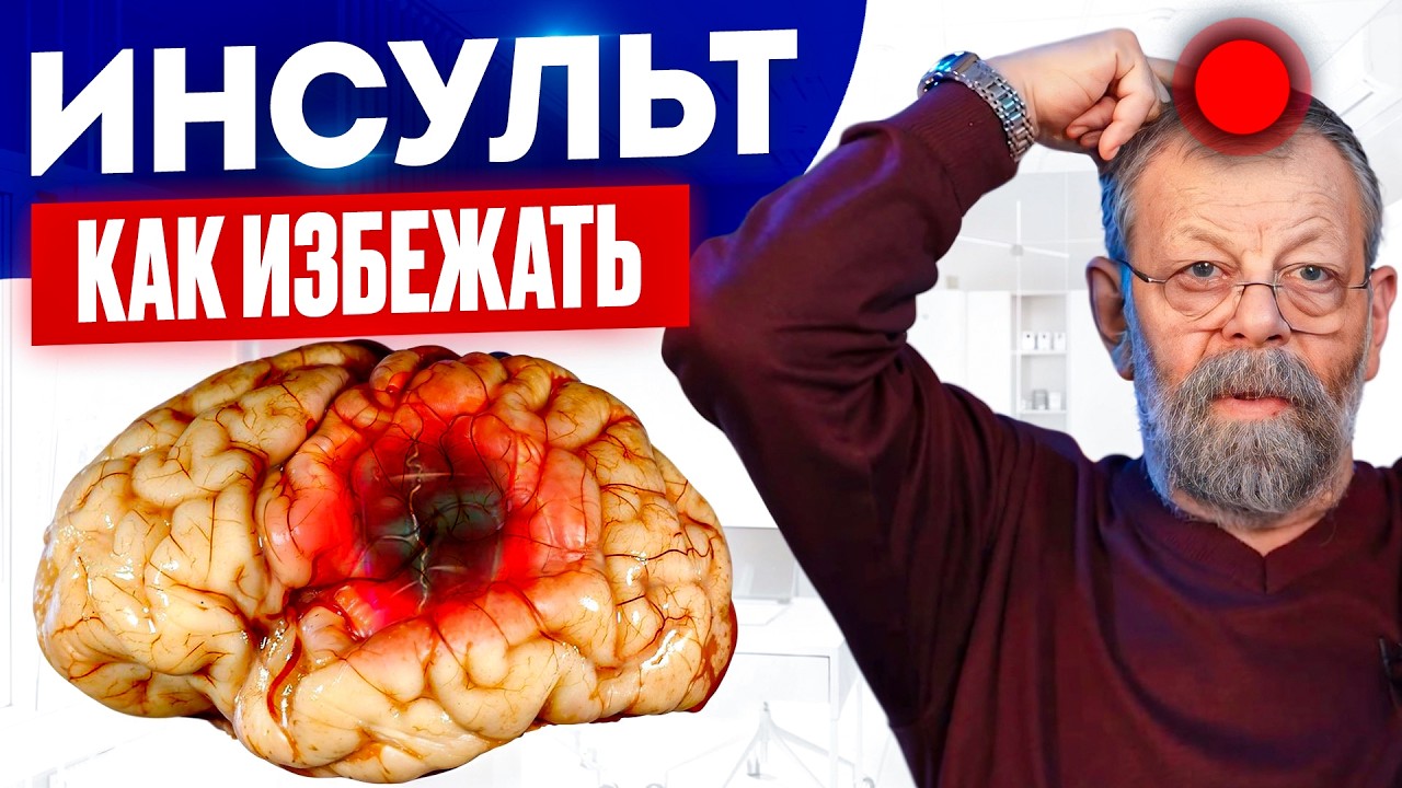 Всего 1 точка предупредит инсульт